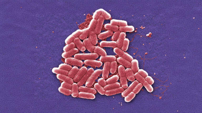 Study Warns: Antibiotic Resistance May Kill Millions by Mid-Century
