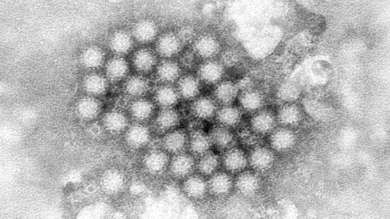 Norovirus Cases Surge Nationwide: What You Need to Know