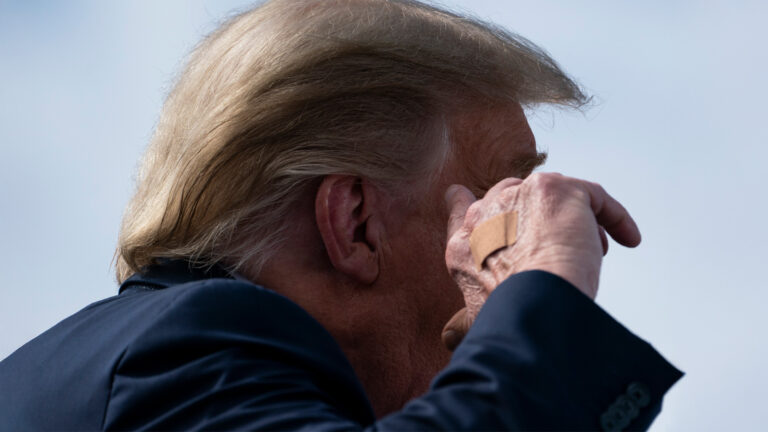 What the White House Says About Trump’s Hand Bandages