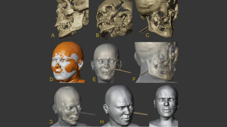 The Face of a ‘Vampire’: 400-Year-Old Skull Reconstructed